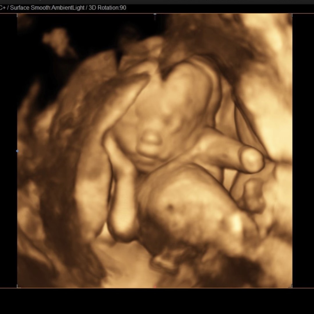 Photo shared by Nida for their Babylist baby registry.