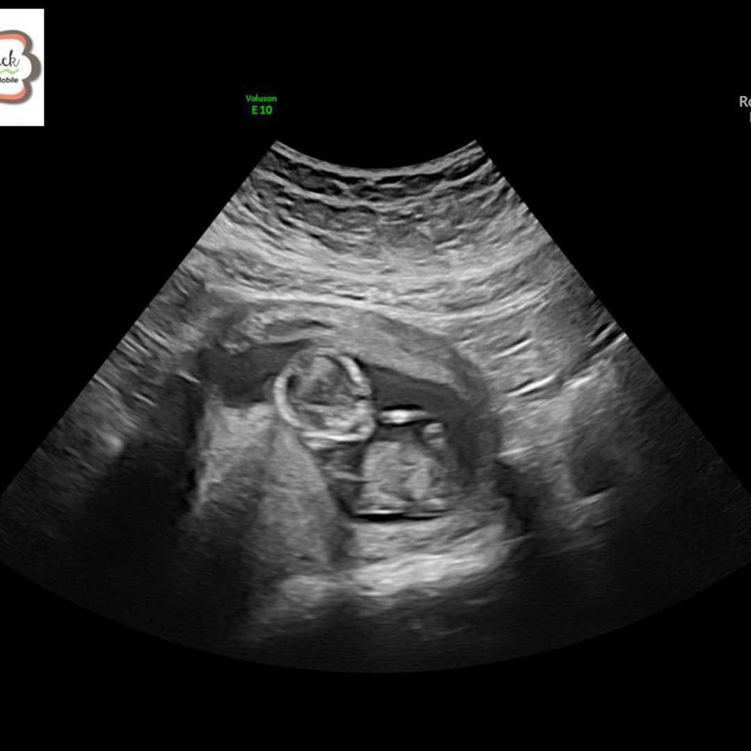 Photo shared by Alyssa for their Babylist baby registry.