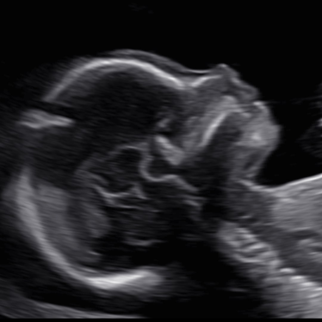 Photo shared by Hannah for their Babylist baby registry.