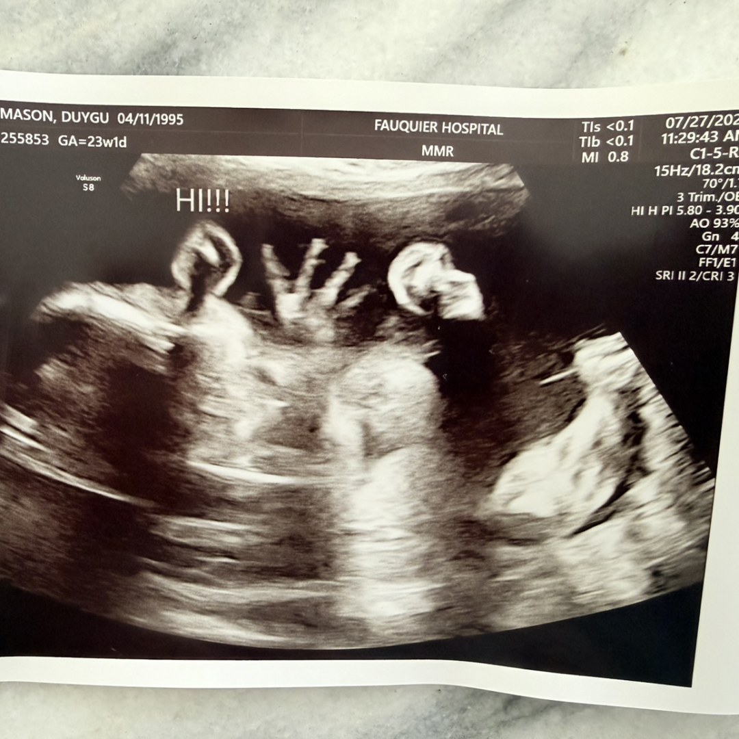 Photo shared by Duygu for their Babylist baby registry.