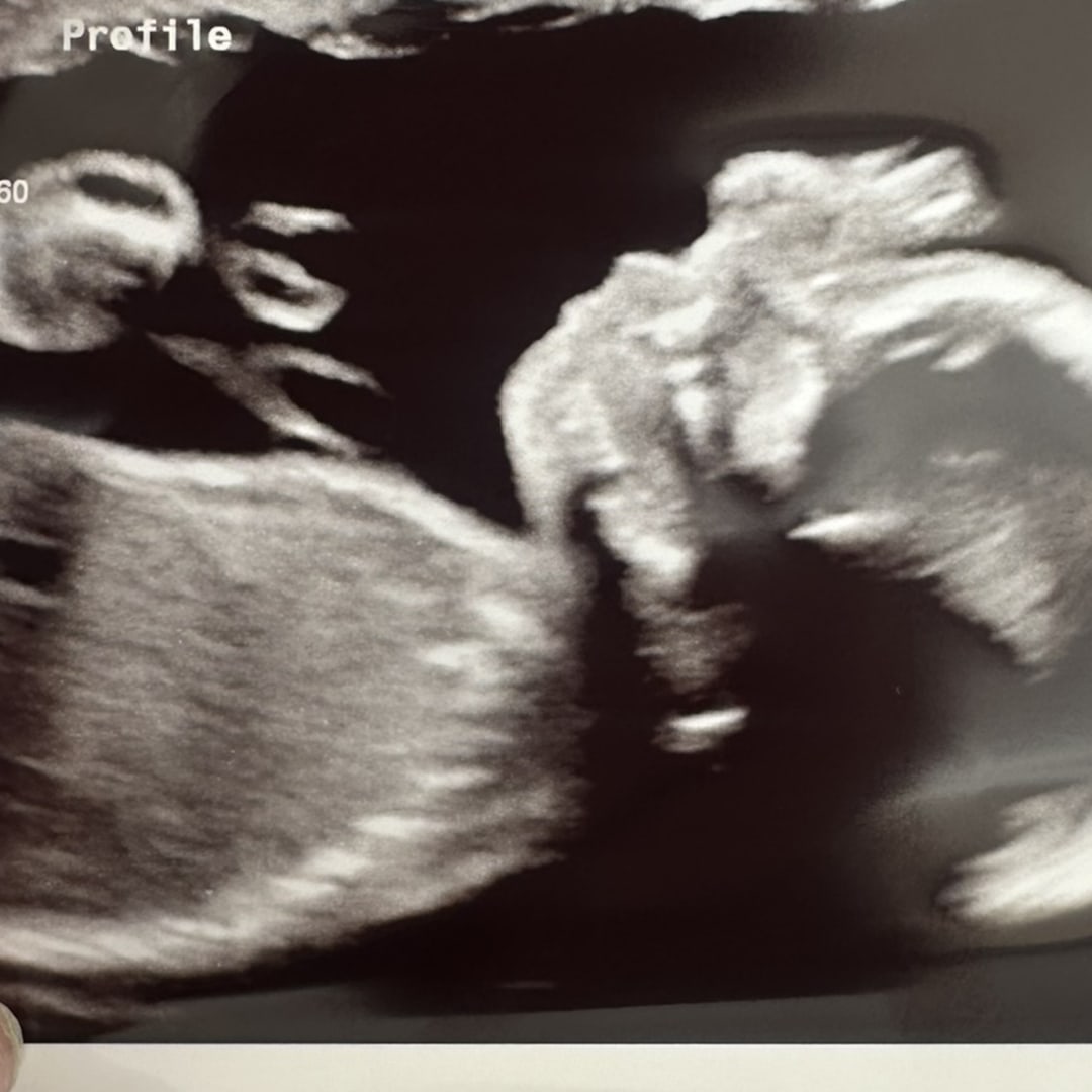 Photo shared by Lucy for their Babylist baby registry.