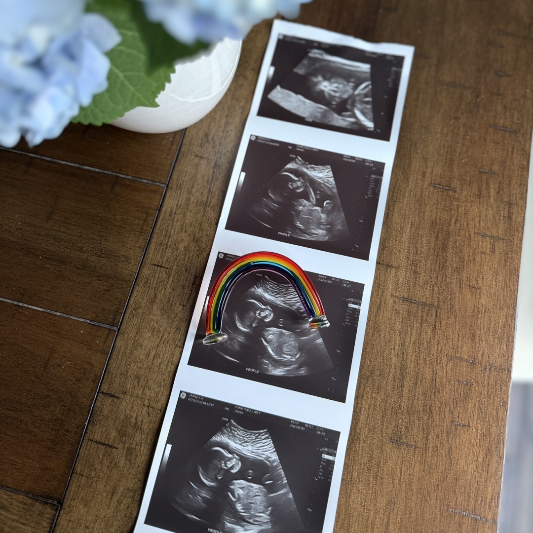 Photo shared by Carey for their Babylist baby registry.