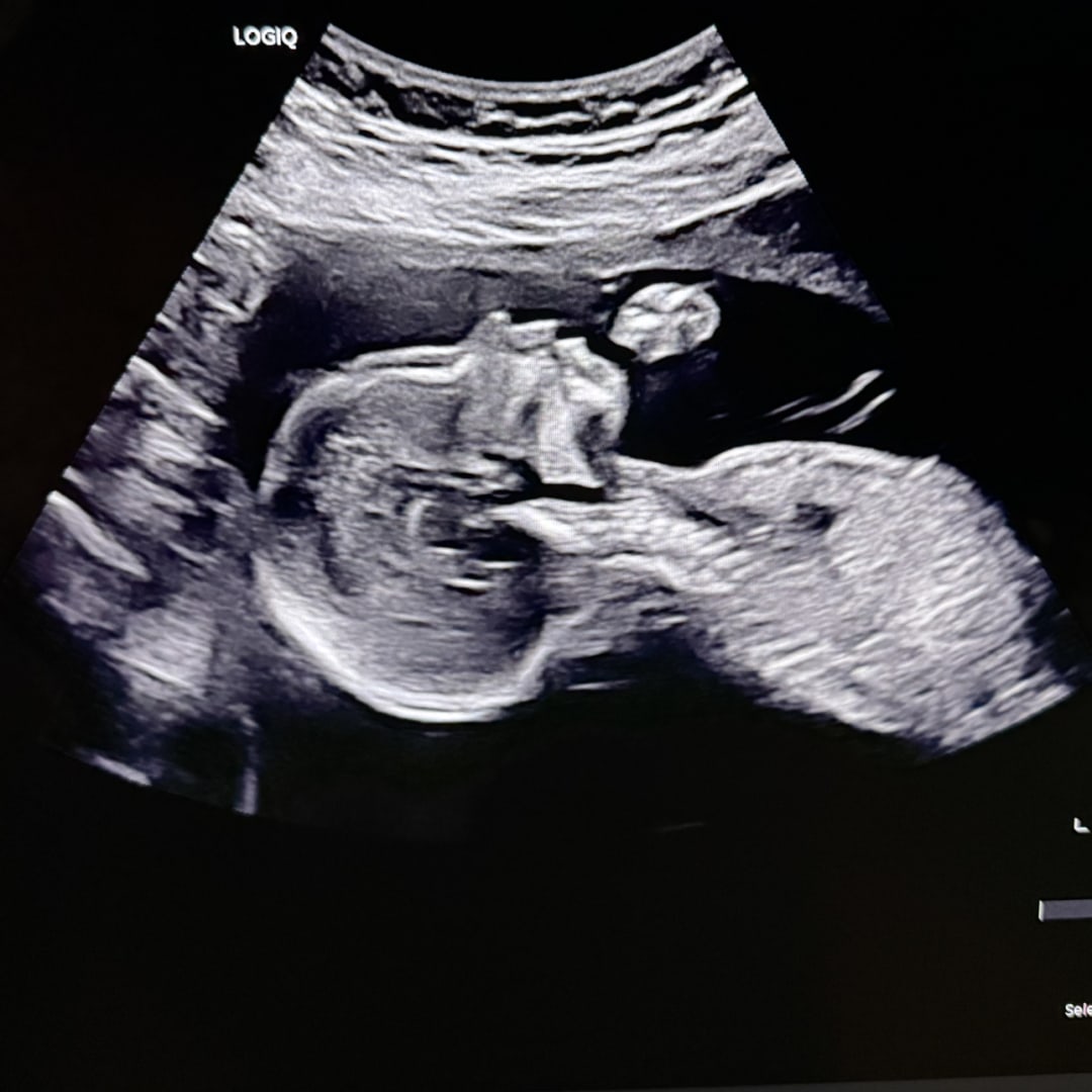 Photo shared by Nickie for their Babylist baby registry.