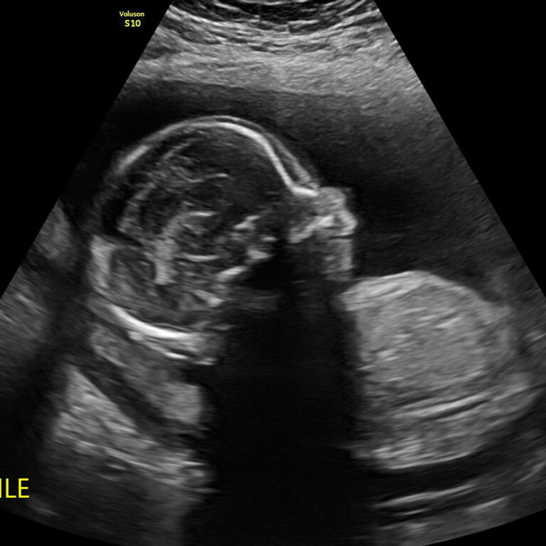 Photo shared by Brooke for their Babylist baby registry.
