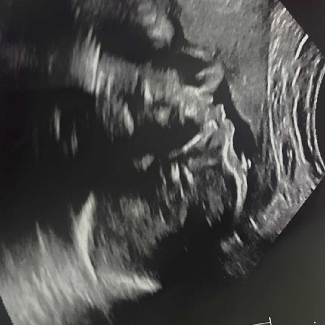 Photo shared by Meljanae for their Babylist baby registry.