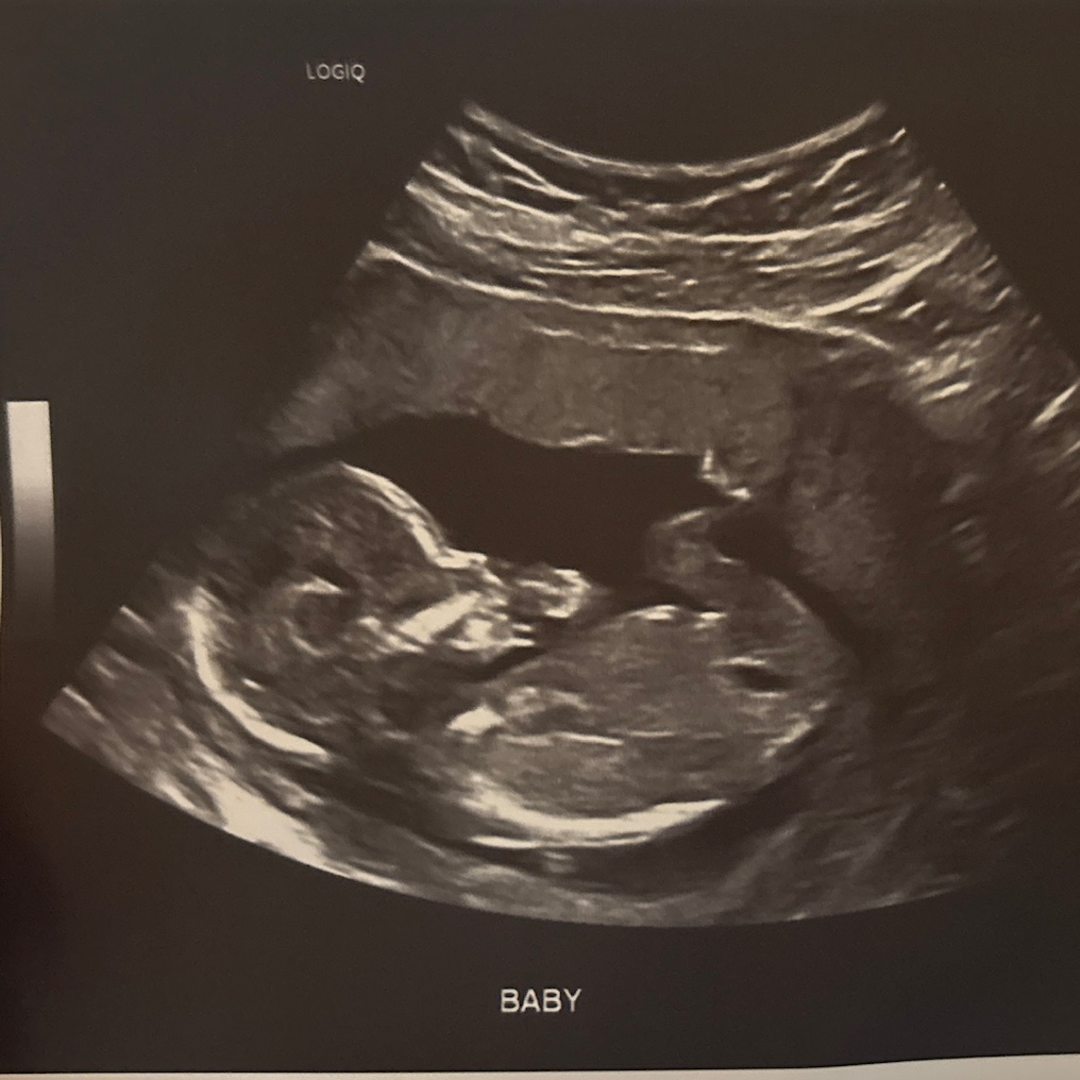 Photo shared by Brianna for their Babylist baby registry.