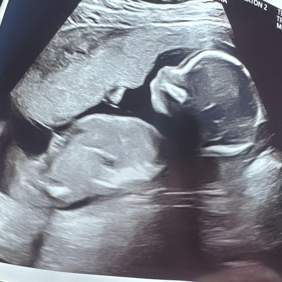 Photo shared by Stephanie for their Babylist baby registry.