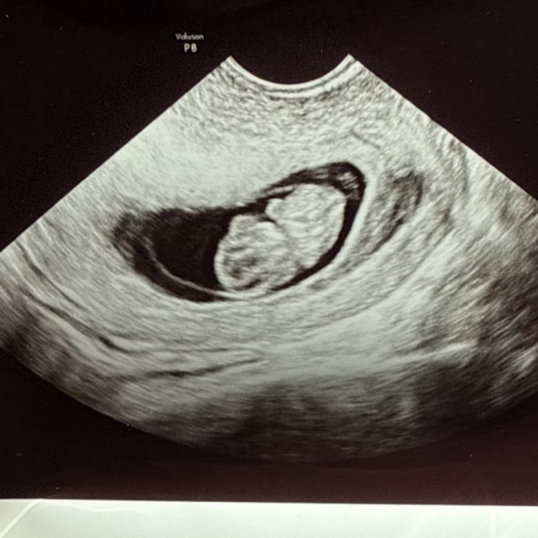Photo shared by Stephanie for their Babylist baby registry.