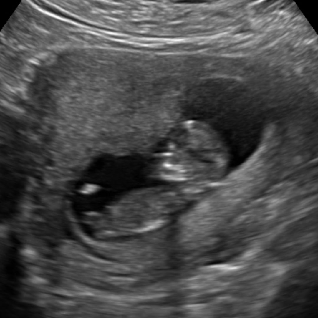 Photo shared by Cassidy for their Babylist baby registry.