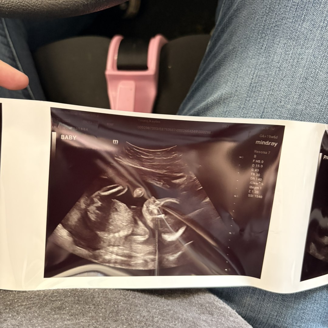 Photo shared by Kaylee for their Babylist baby registry.