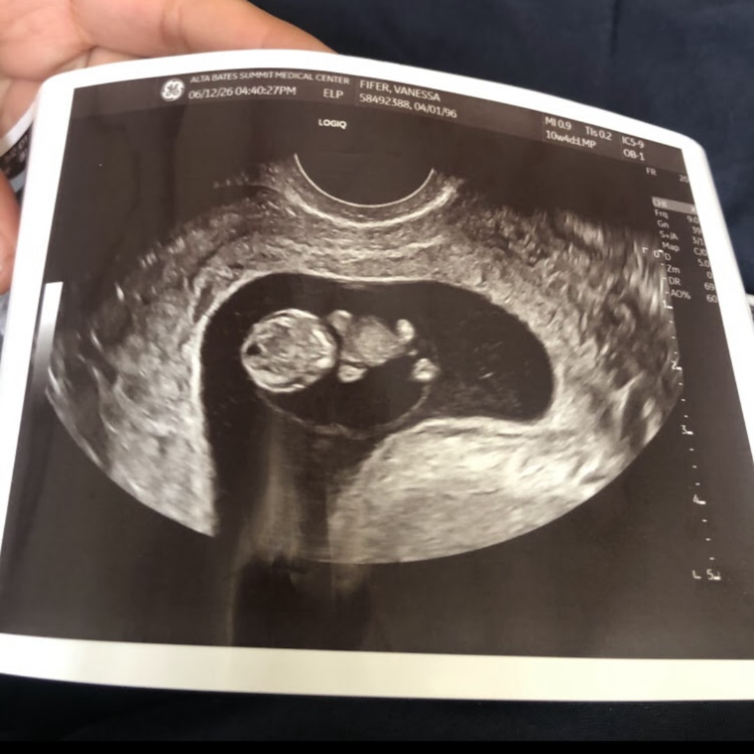 Photo shared by Vanessa for their Babylist baby registry.