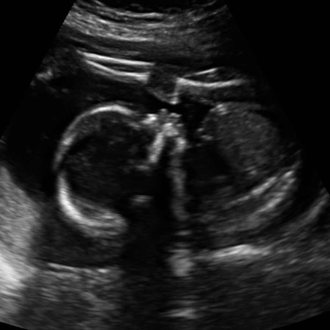 Photo shared by Kersten for their Babylist baby registry.