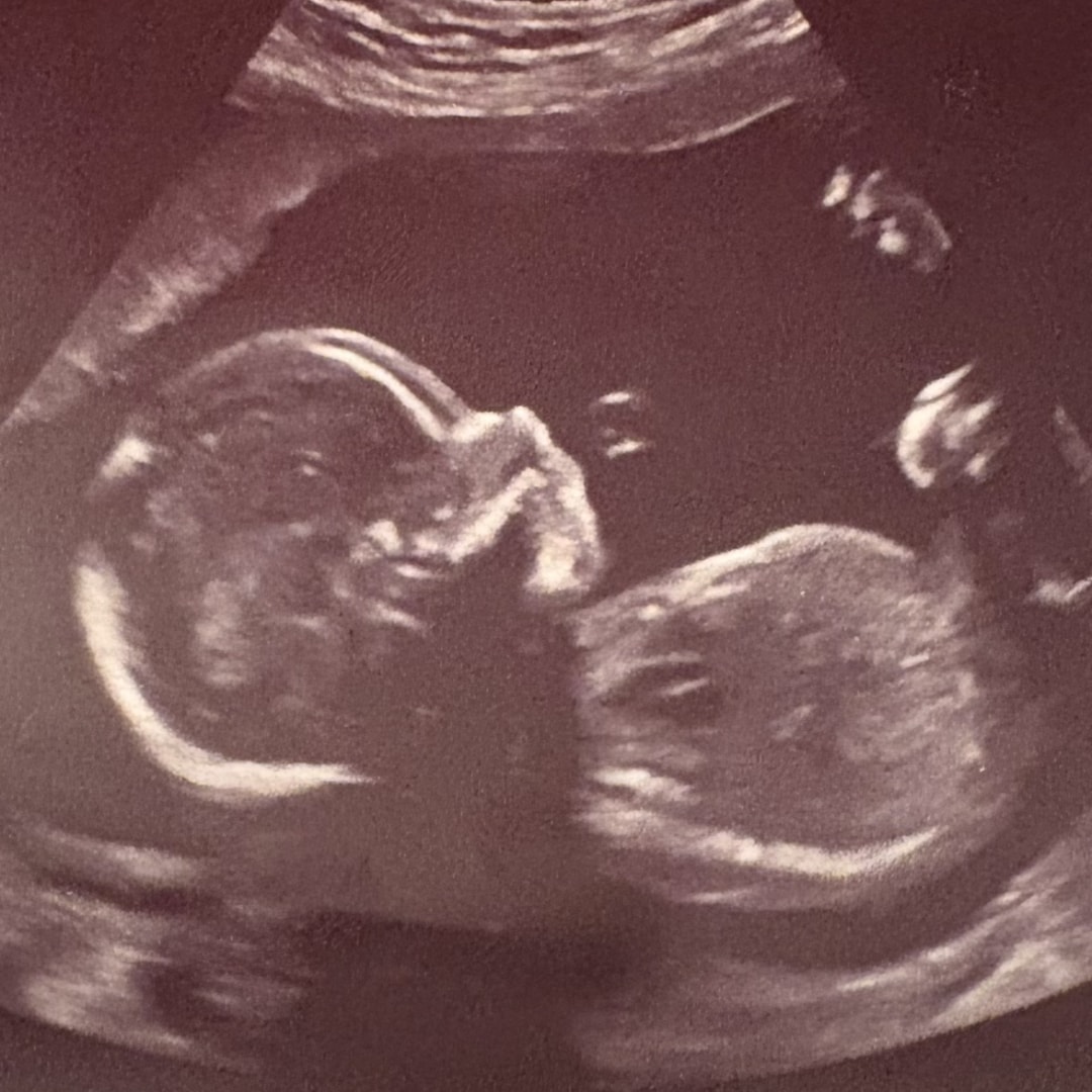 Photo shared by Grace for their Babylist baby registry.