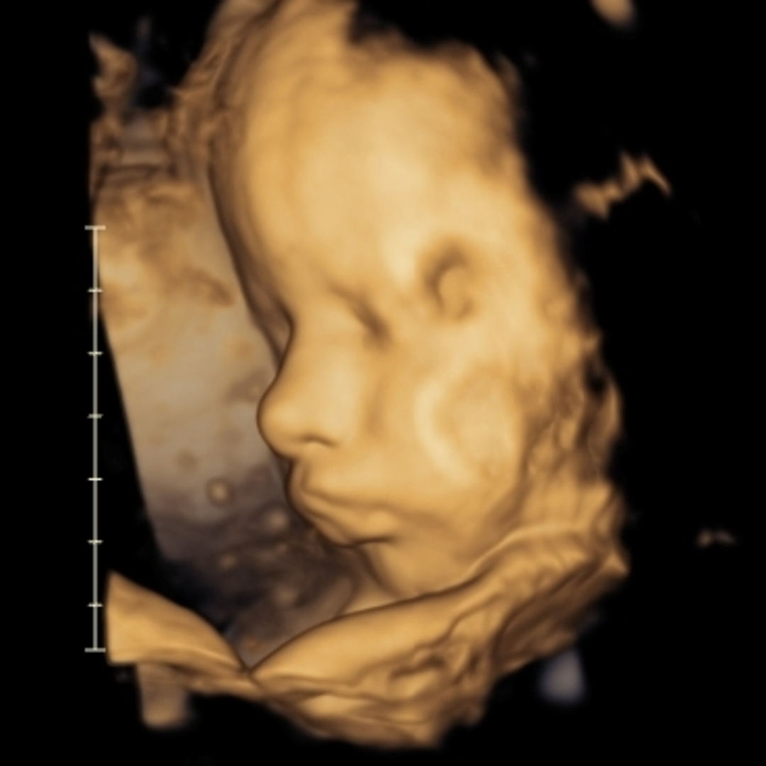 Photo shared by Maridole for their Babylist baby registry.