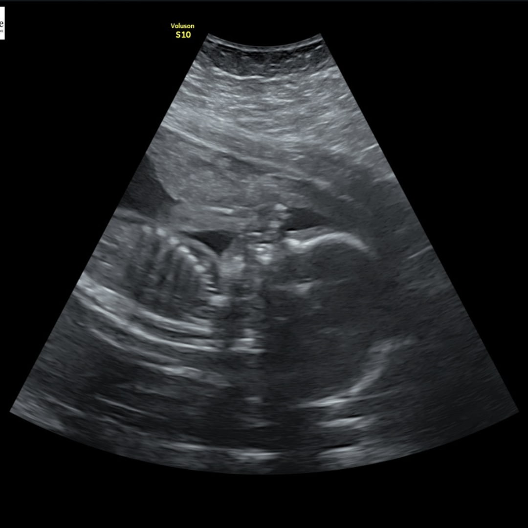 Photo shared by Tyra for their Babylist baby registry.