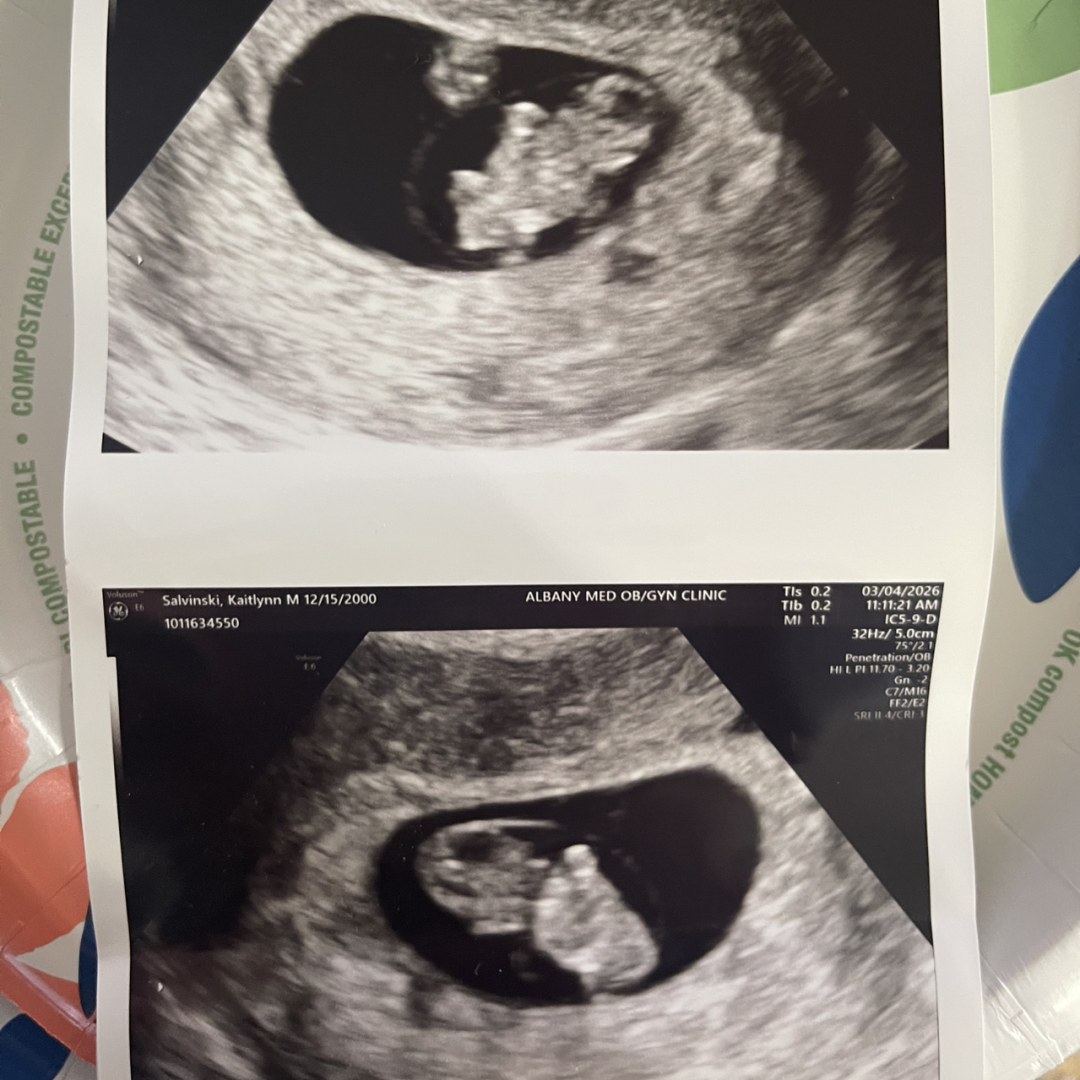 Photo shared by Kaitlynn for their Babylist baby registry.