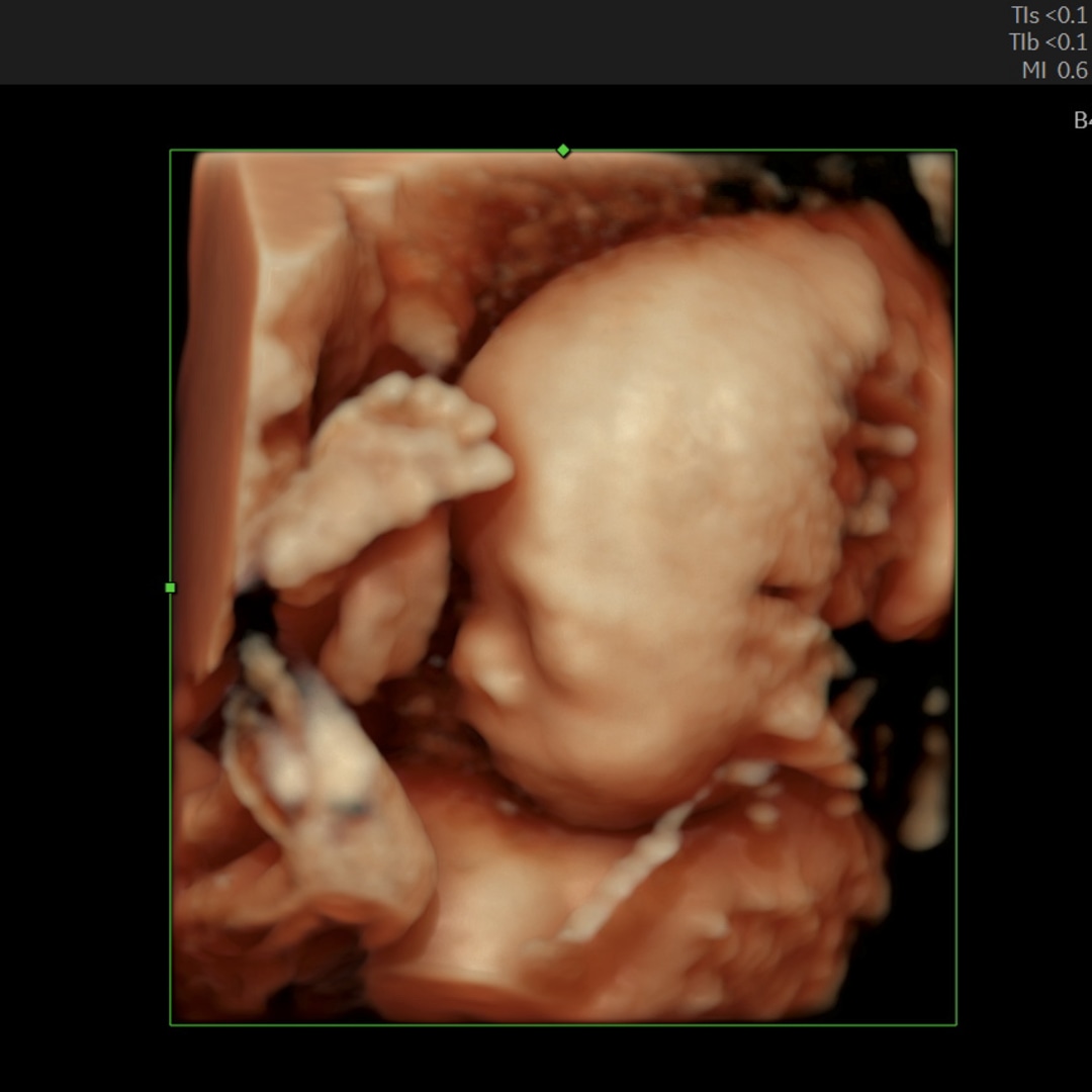 Photo shared by Maya for their Babylist baby registry.