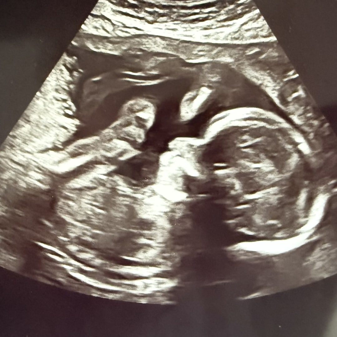 Photo shared by Kimberly for their Babylist baby registry.