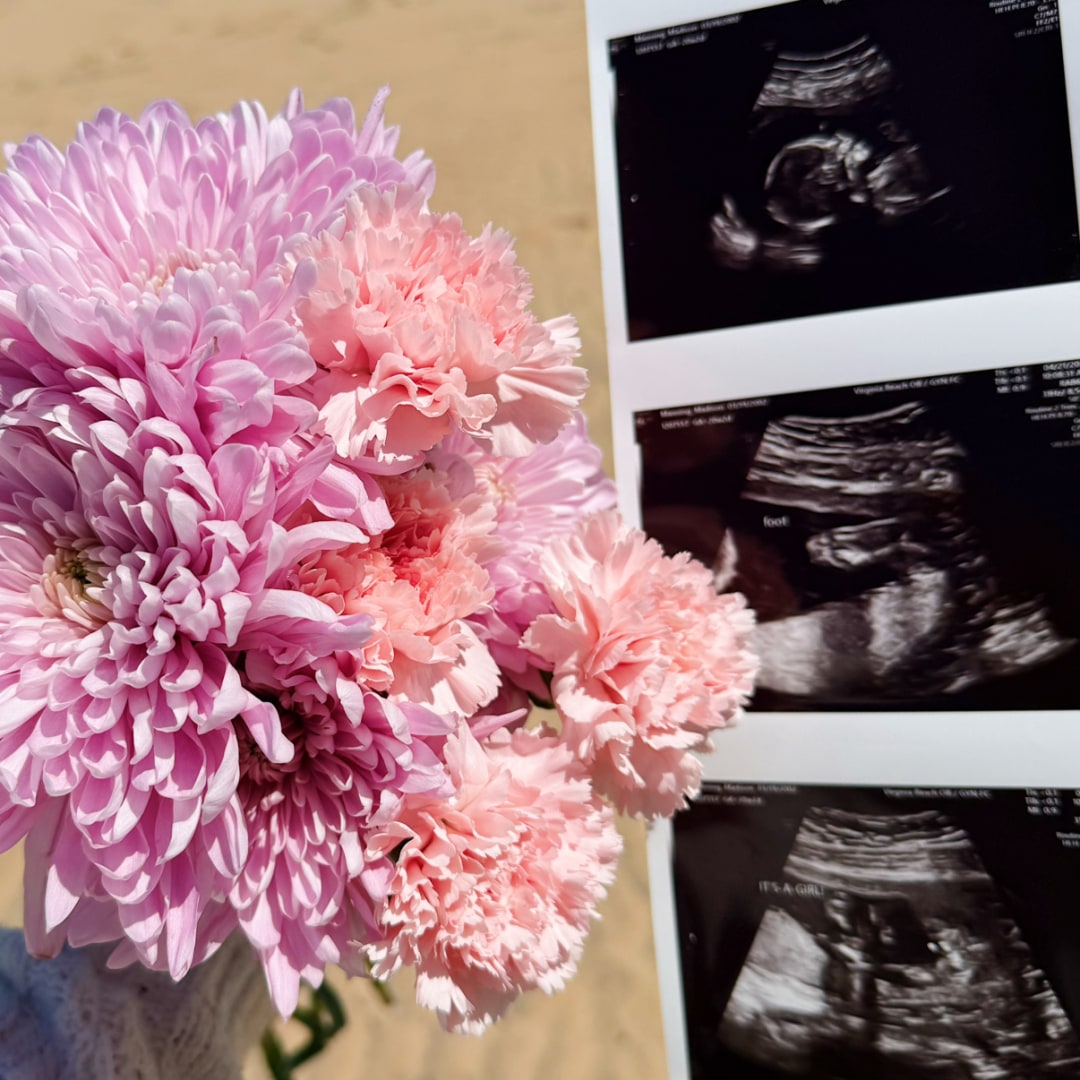 Photo shared by Madison for their Babylist baby registry.