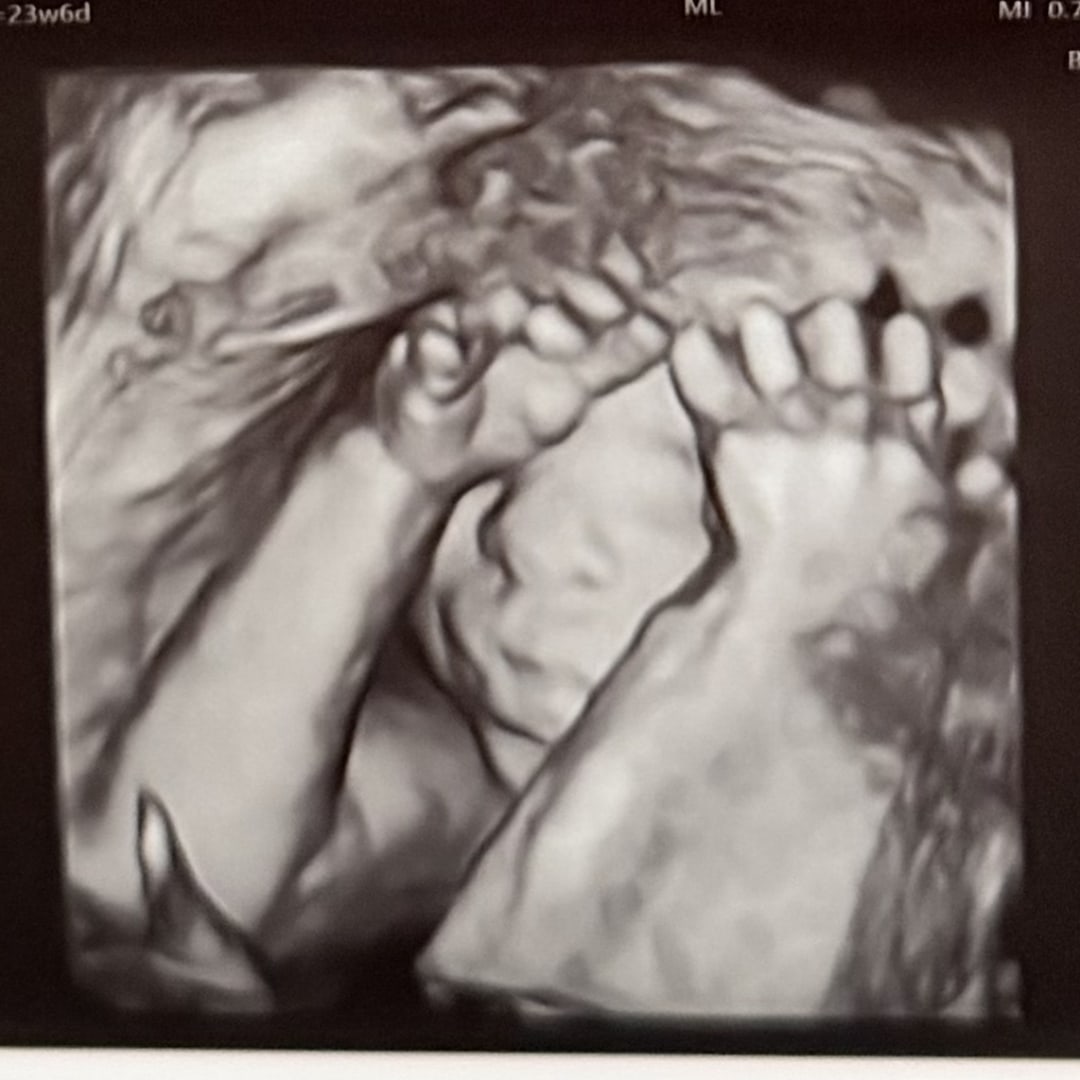 Photo shared by Brittany for their Babylist baby registry.