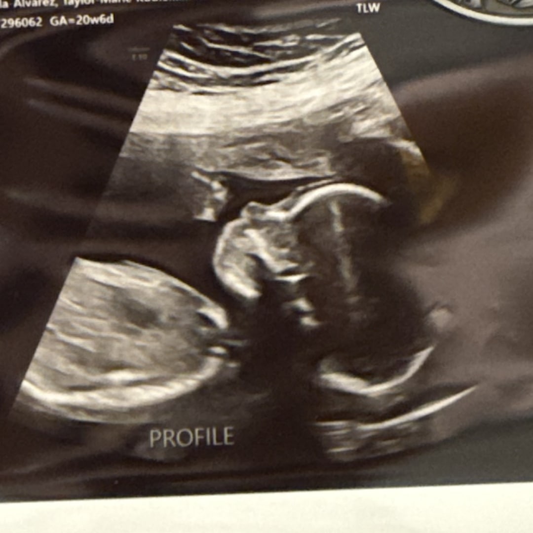 Photo shared by Taylor-Marie for their Babylist baby registry.