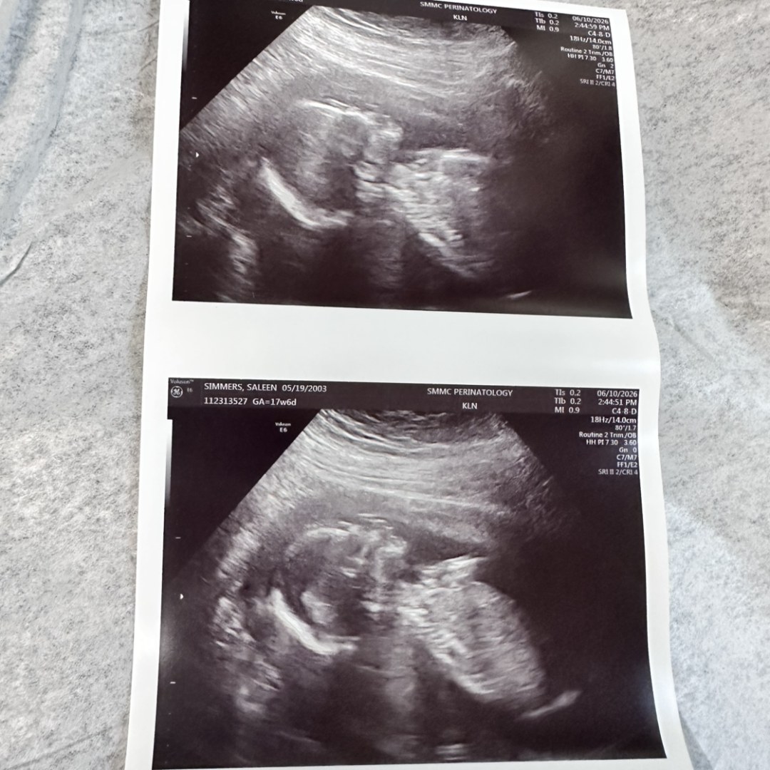 Photo shared by Saleen for their Babylist baby registry.