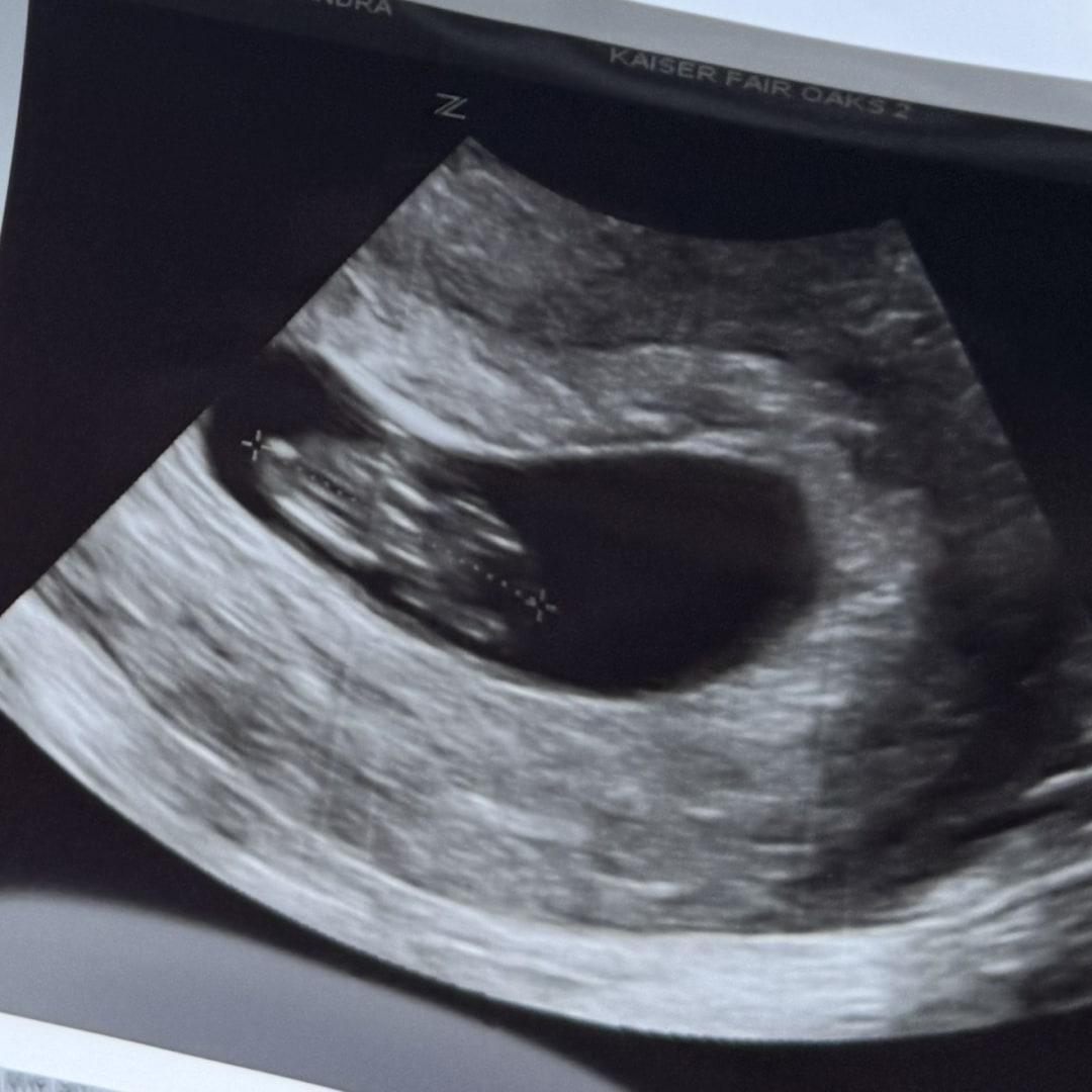Photo shared by Lexi for their Babylist baby registry.