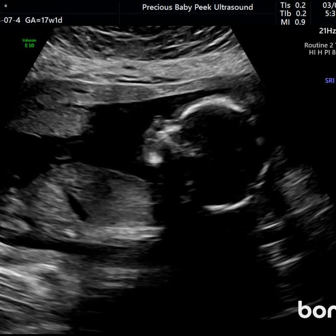 Photo shared by Katelynn for their Babylist baby registry.