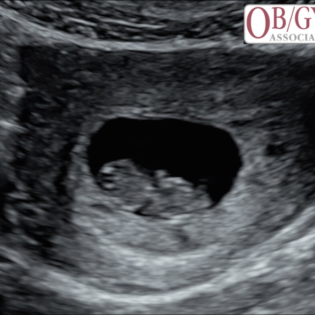 Photo shared by Jordyn for their Babylist baby registry.
