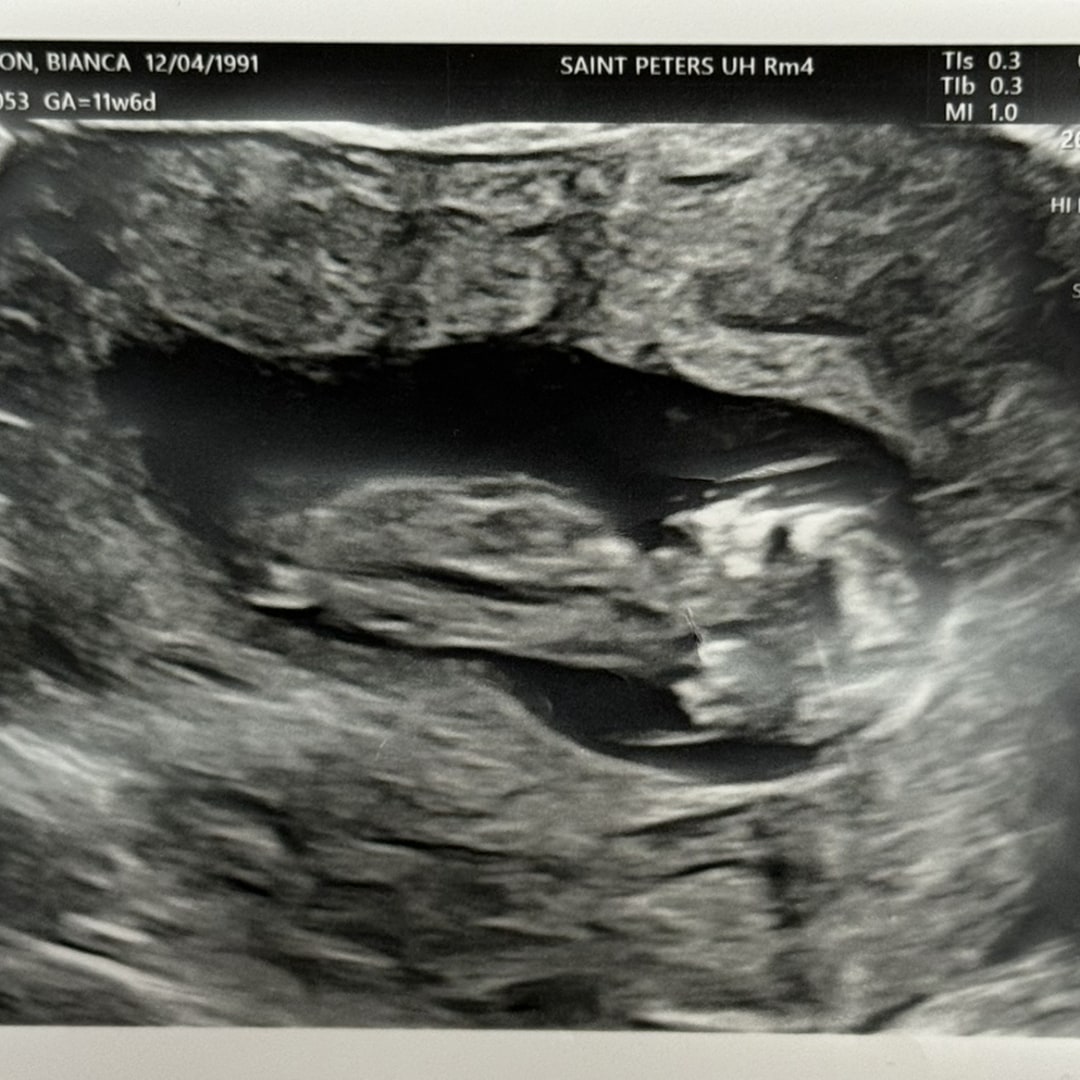 Photo shared by Bianca for their Babylist baby registry.