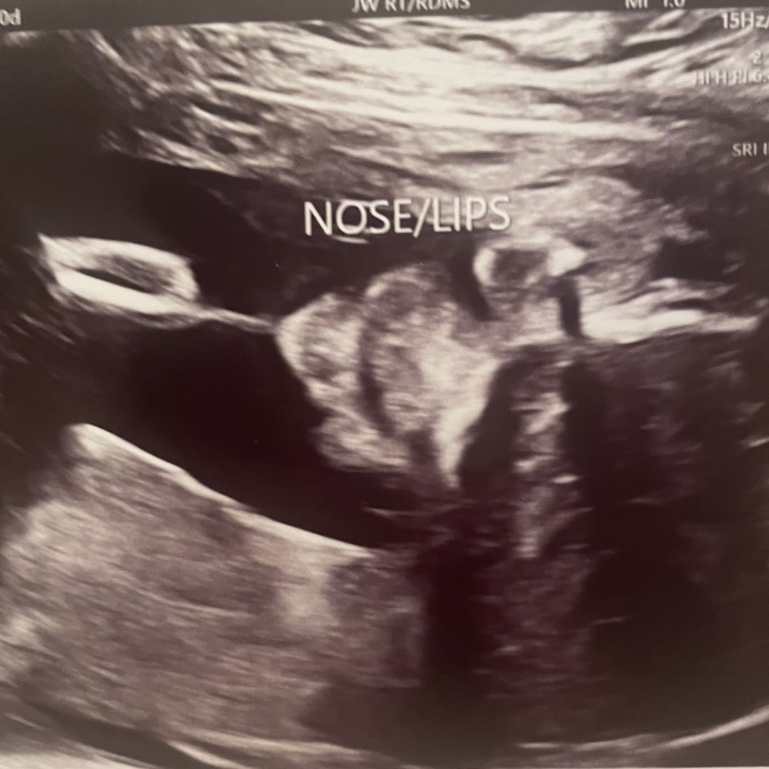 Photo shared by Hope for their Babylist baby registry.