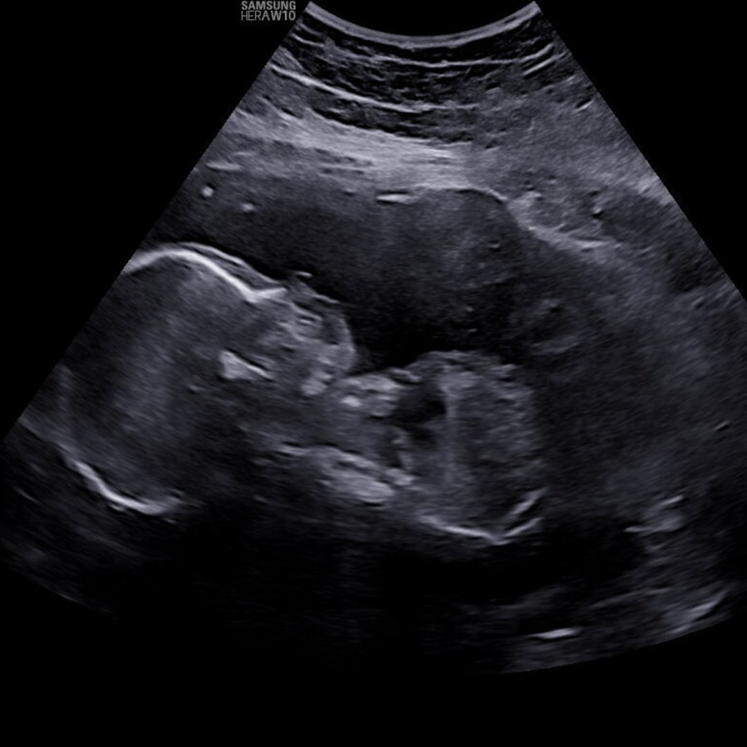 Photo shared by Monika for their Babylist baby registry.