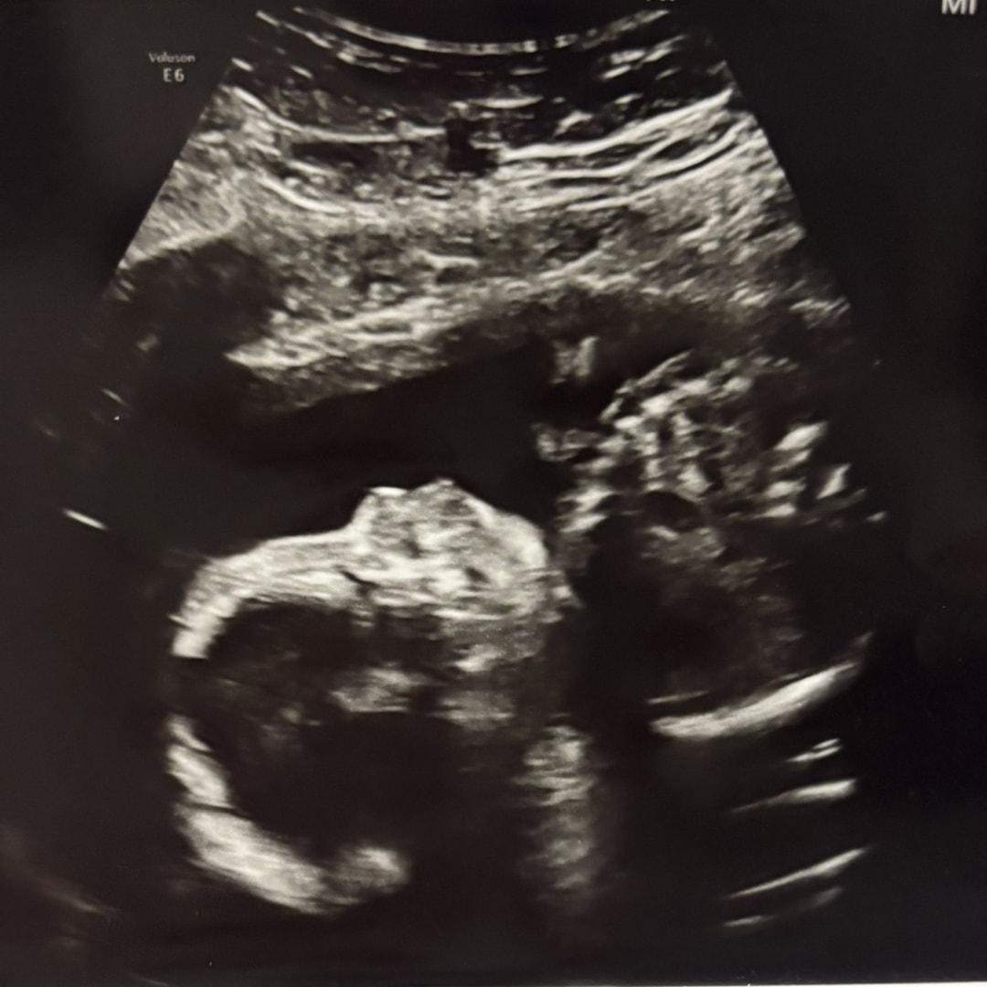 Photo shared by Lindsay for their Babylist baby registry.