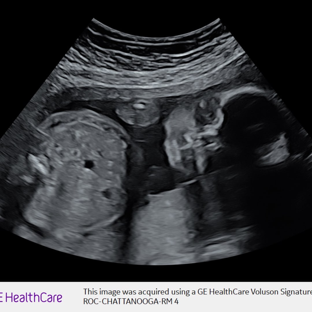 Photo shared by Neely for their Babylist baby registry.