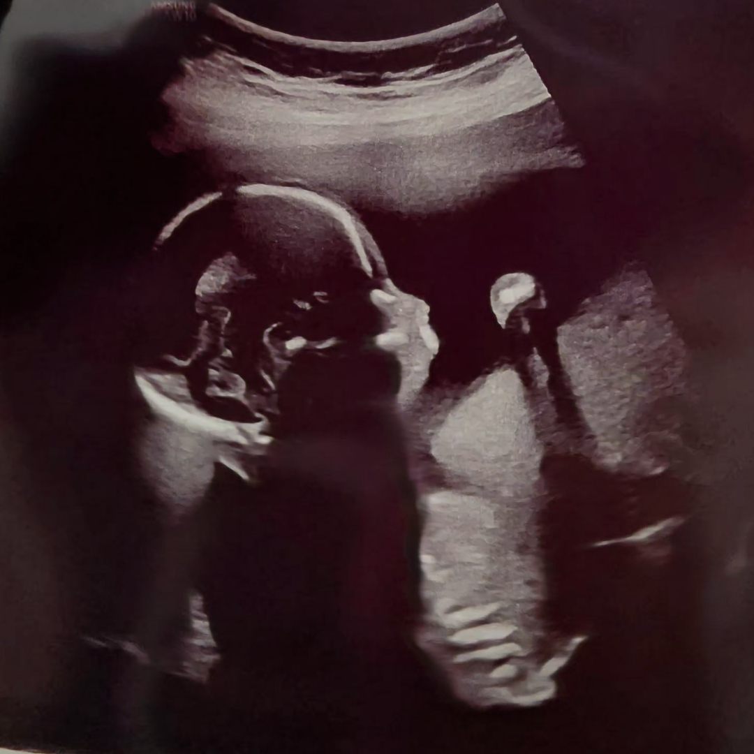 Photo shared by Alyssa for their Babylist baby registry.