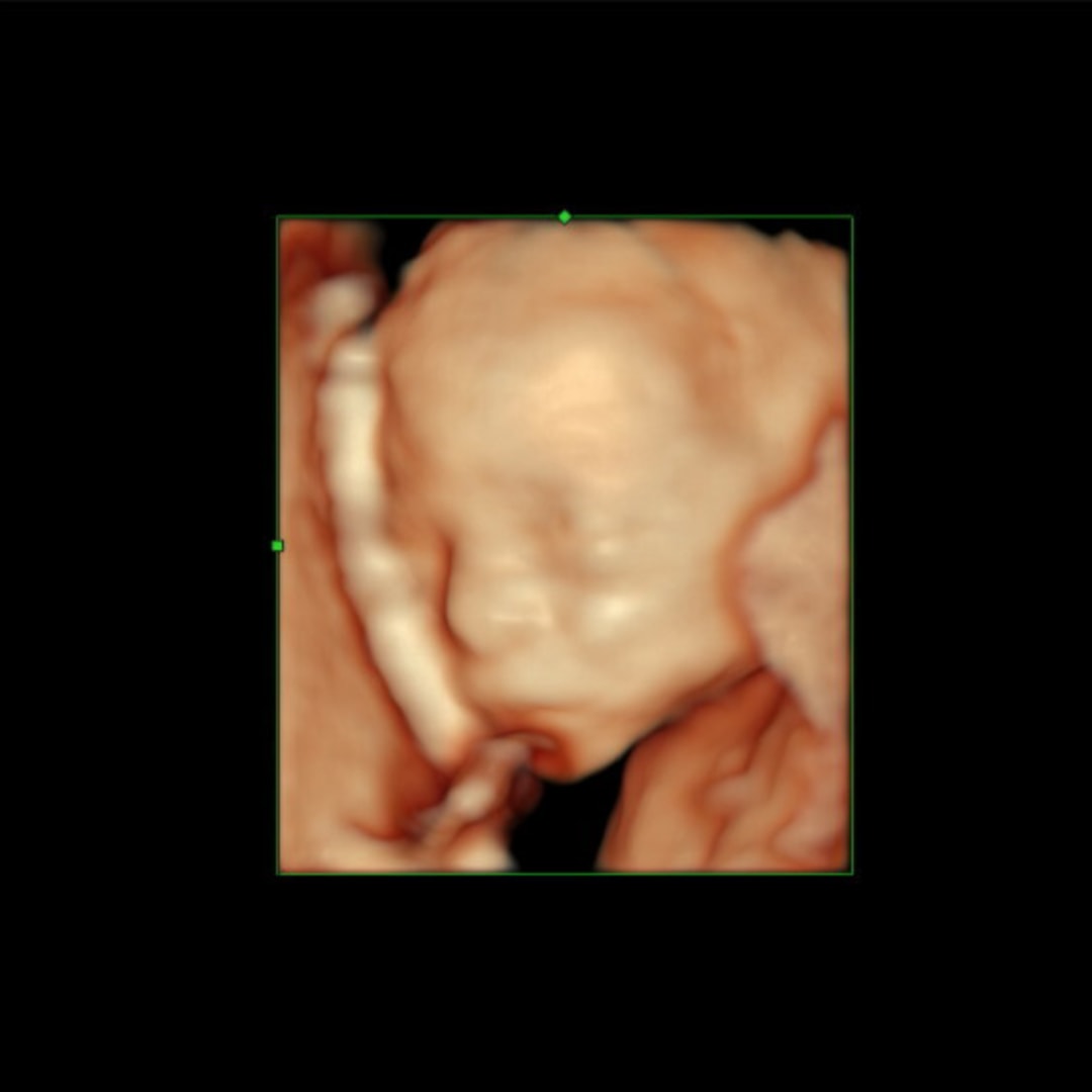 Photo shared by Stefany for their Babylist baby registry.