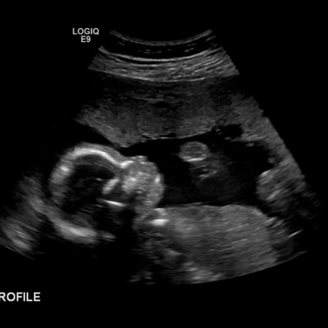 Photo shared by Andrea for their Babylist baby registry.