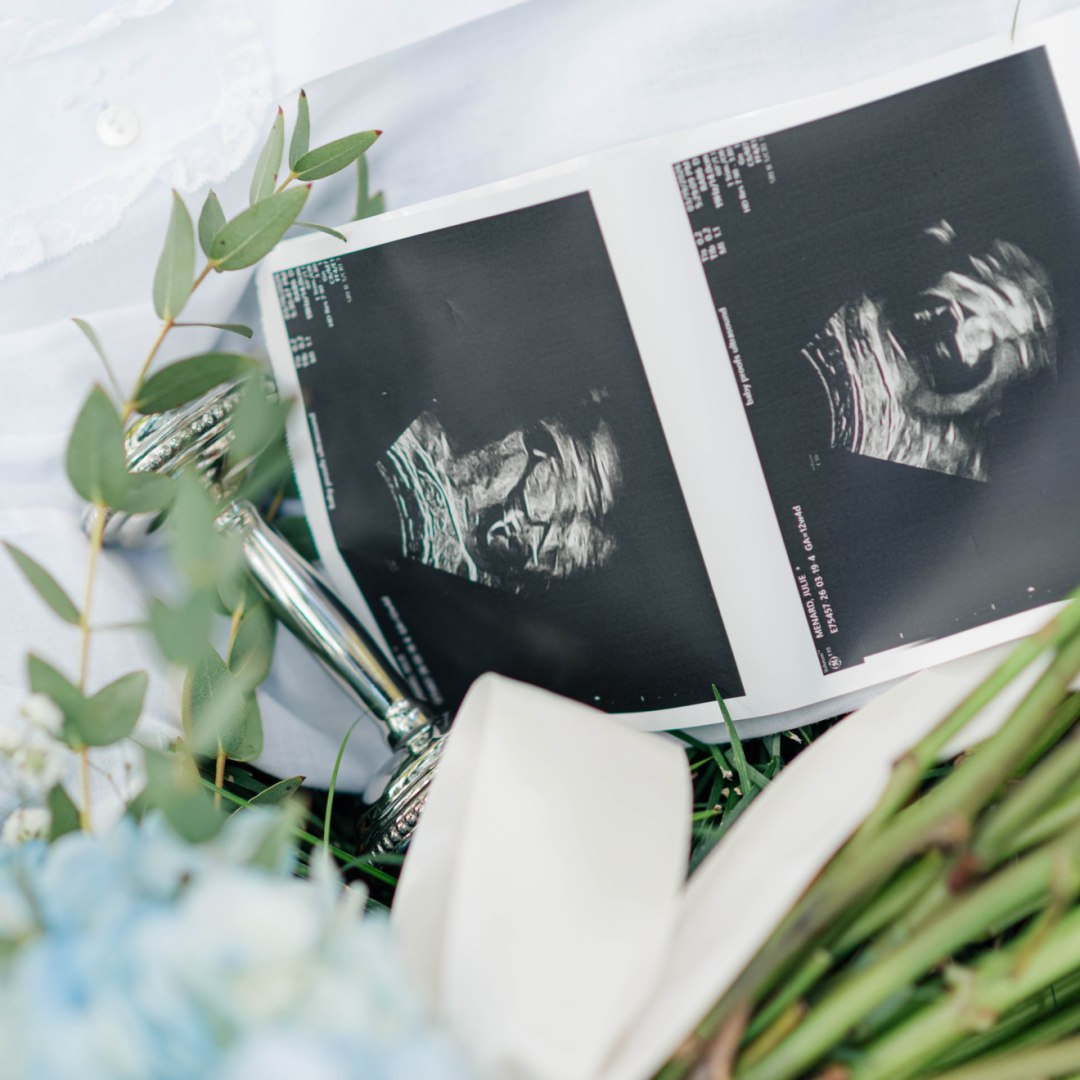 Photo shared by Julie for their Babylist baby registry.