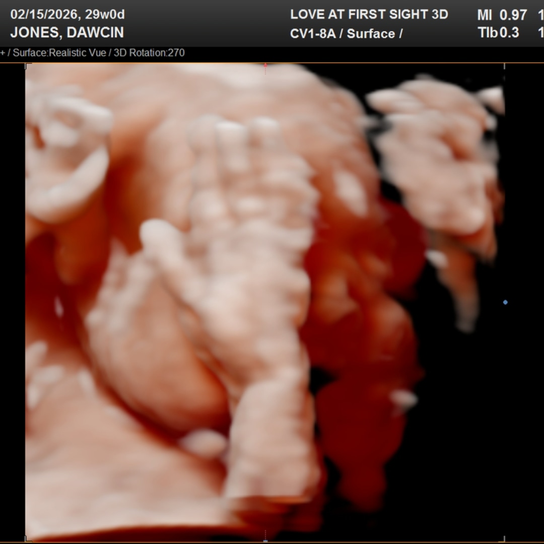 Photo shared by Dawcin for their Babylist baby registry.