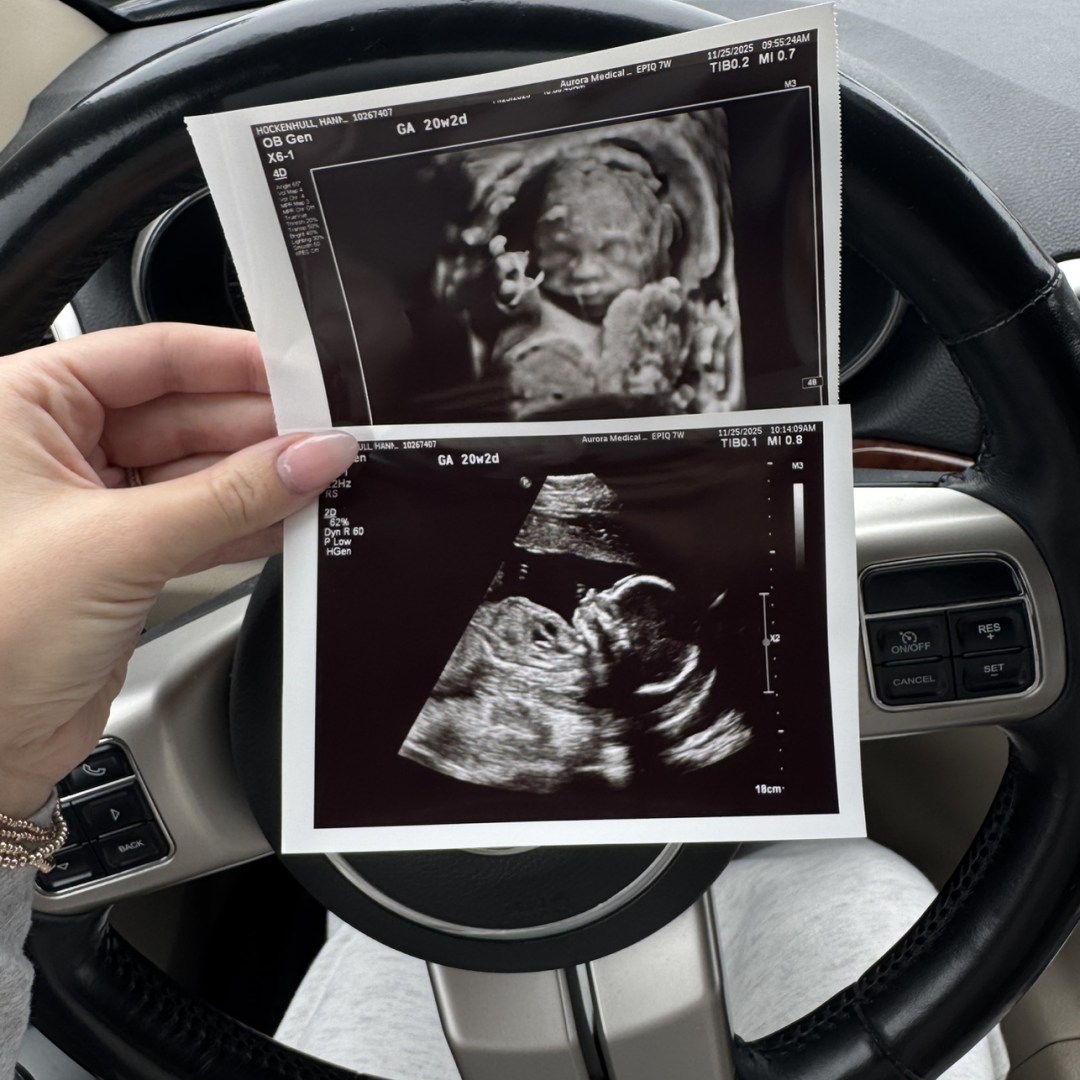 Photo shared by Hannah for their Babylist baby registry.