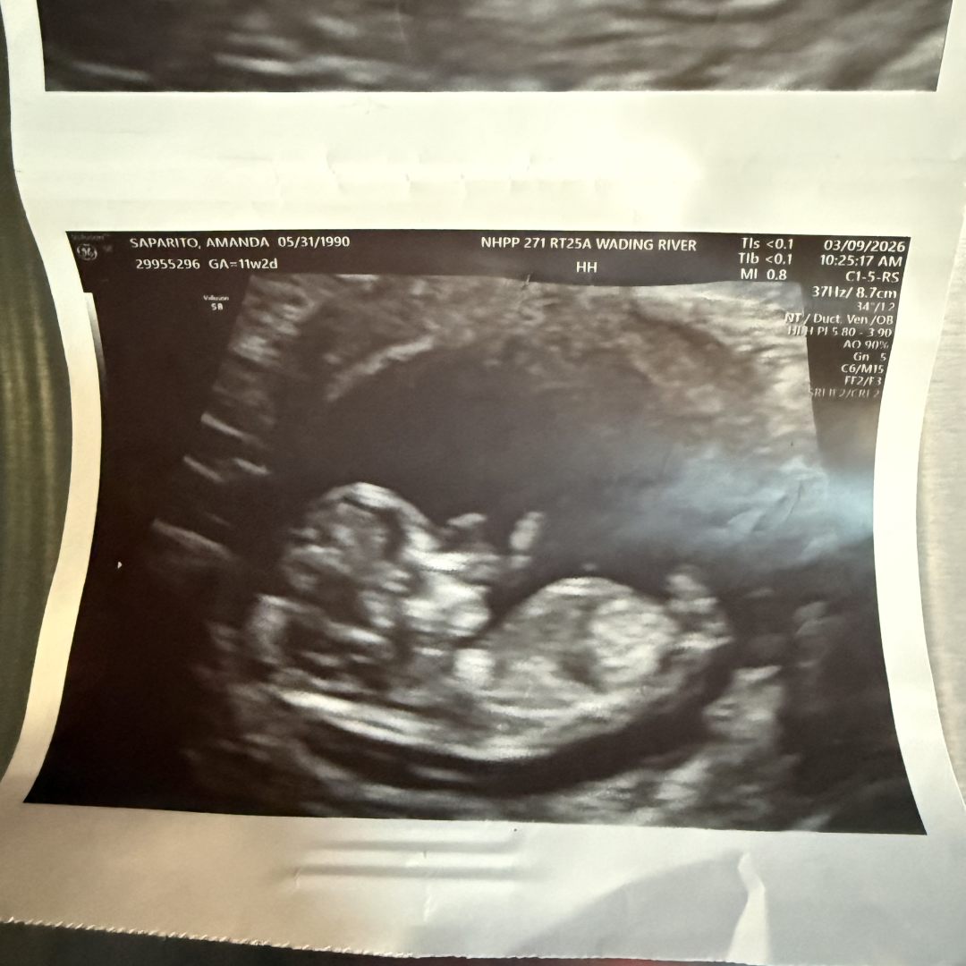 Photo shared by Amanda for their Babylist baby registry.
