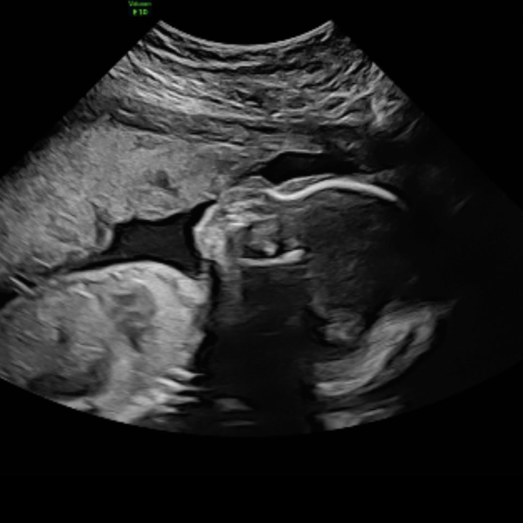 Photo shared by Shaniah for their Babylist baby registry.