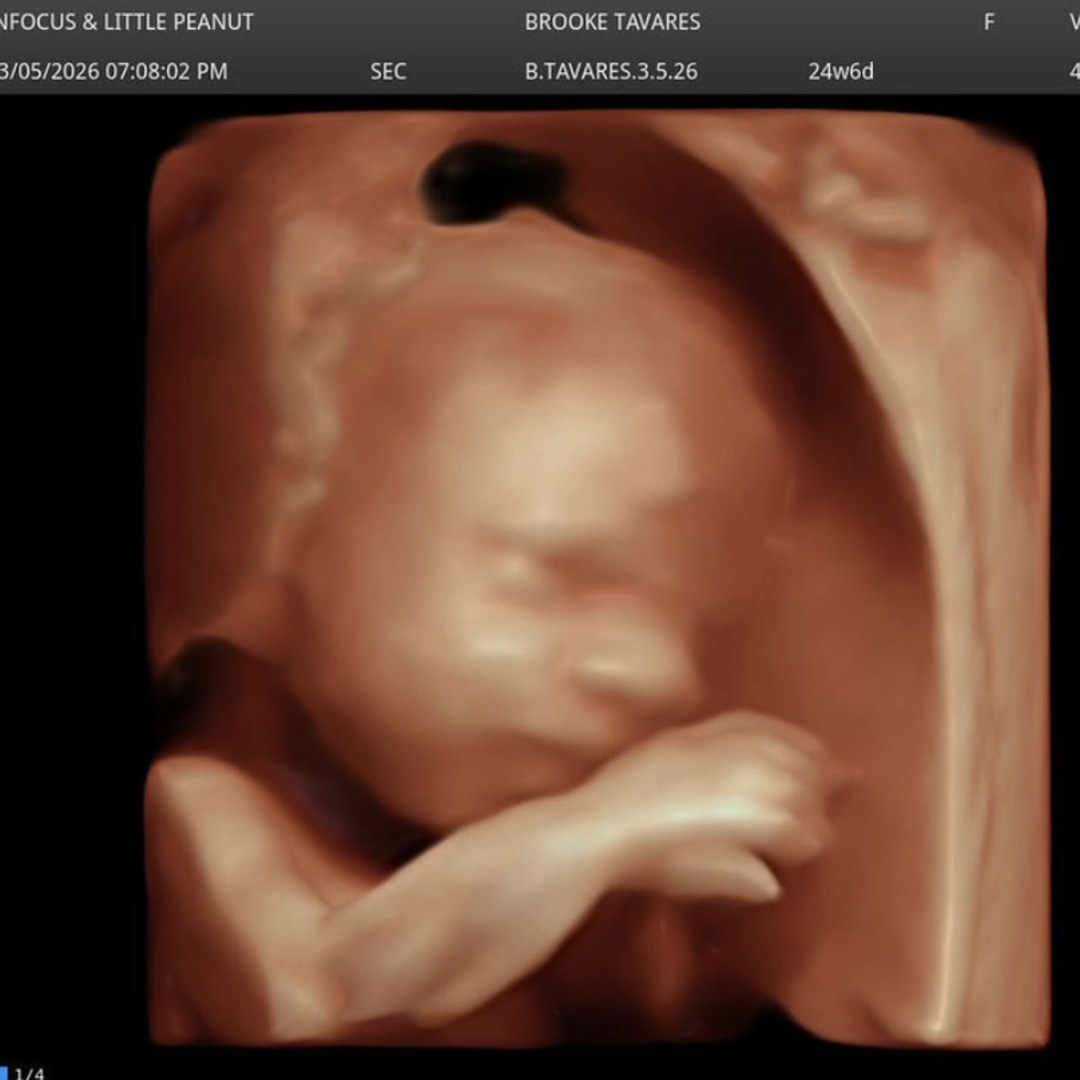 Photo shared by Brooke for their Babylist baby registry.