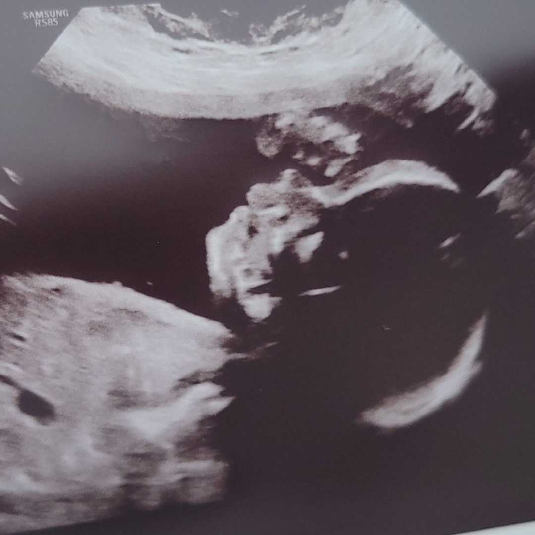 Photo shared by Nikita for their Babylist baby registry.