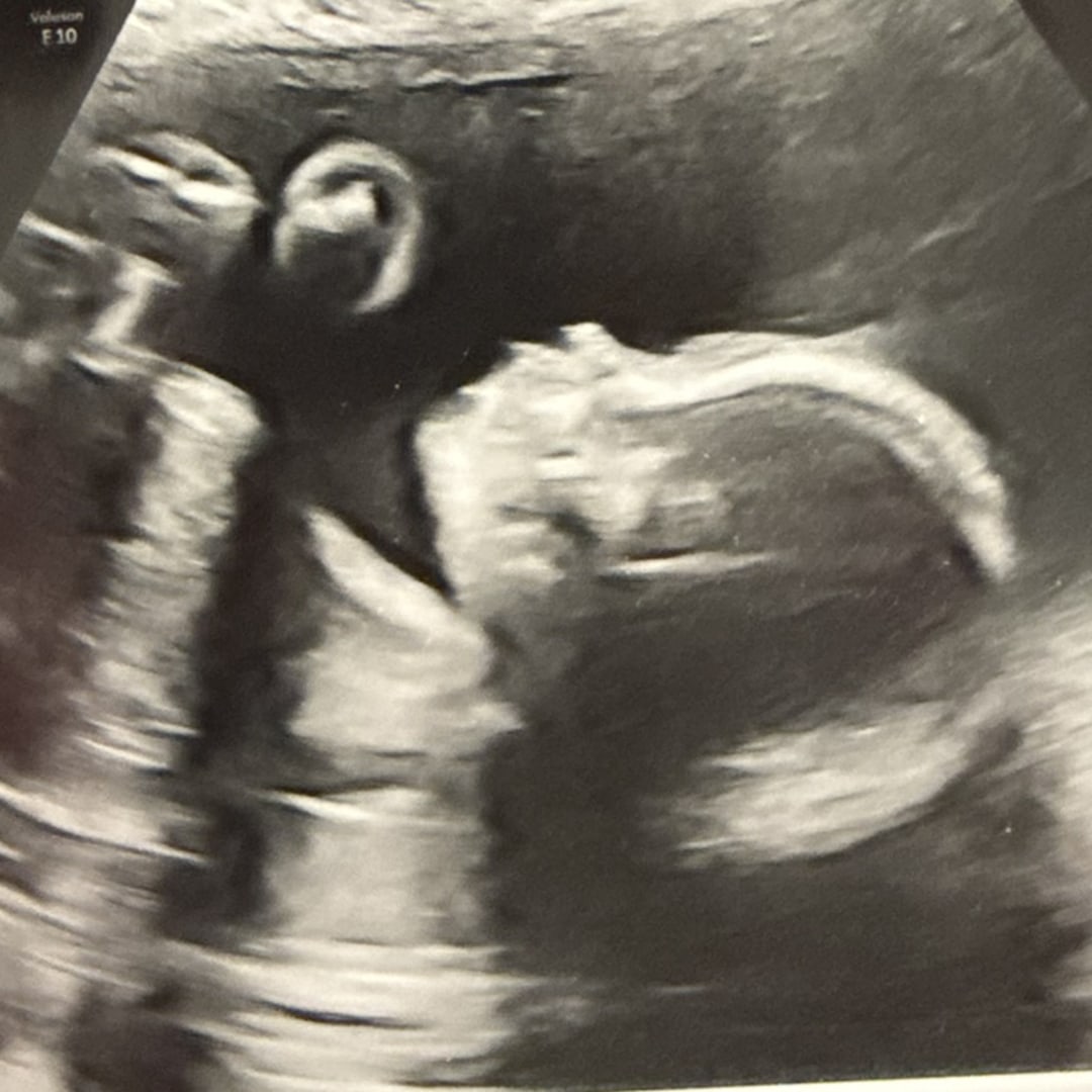 Photo shared by Emily for their Babylist baby registry.