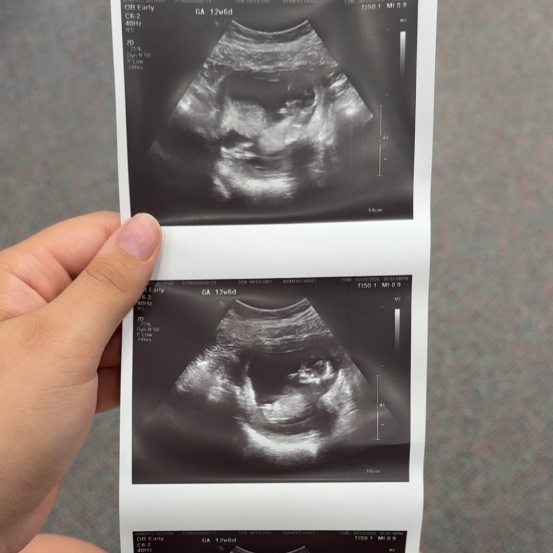Photo shared by Alliyah for their Babylist baby registry.