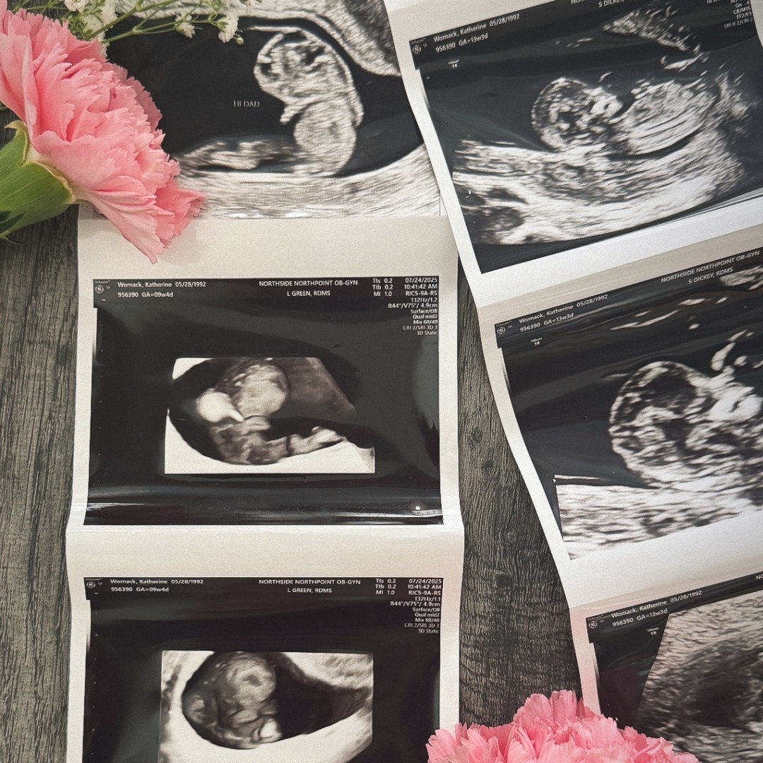 Photo shared by Kate for their Babylist baby registry.