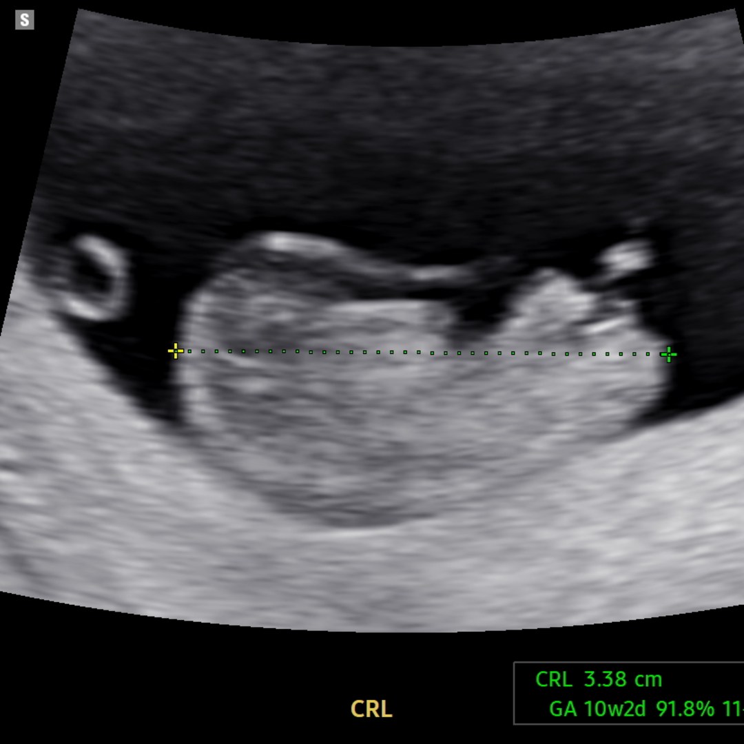 Photo shared by Annie for their Babylist baby registry.
