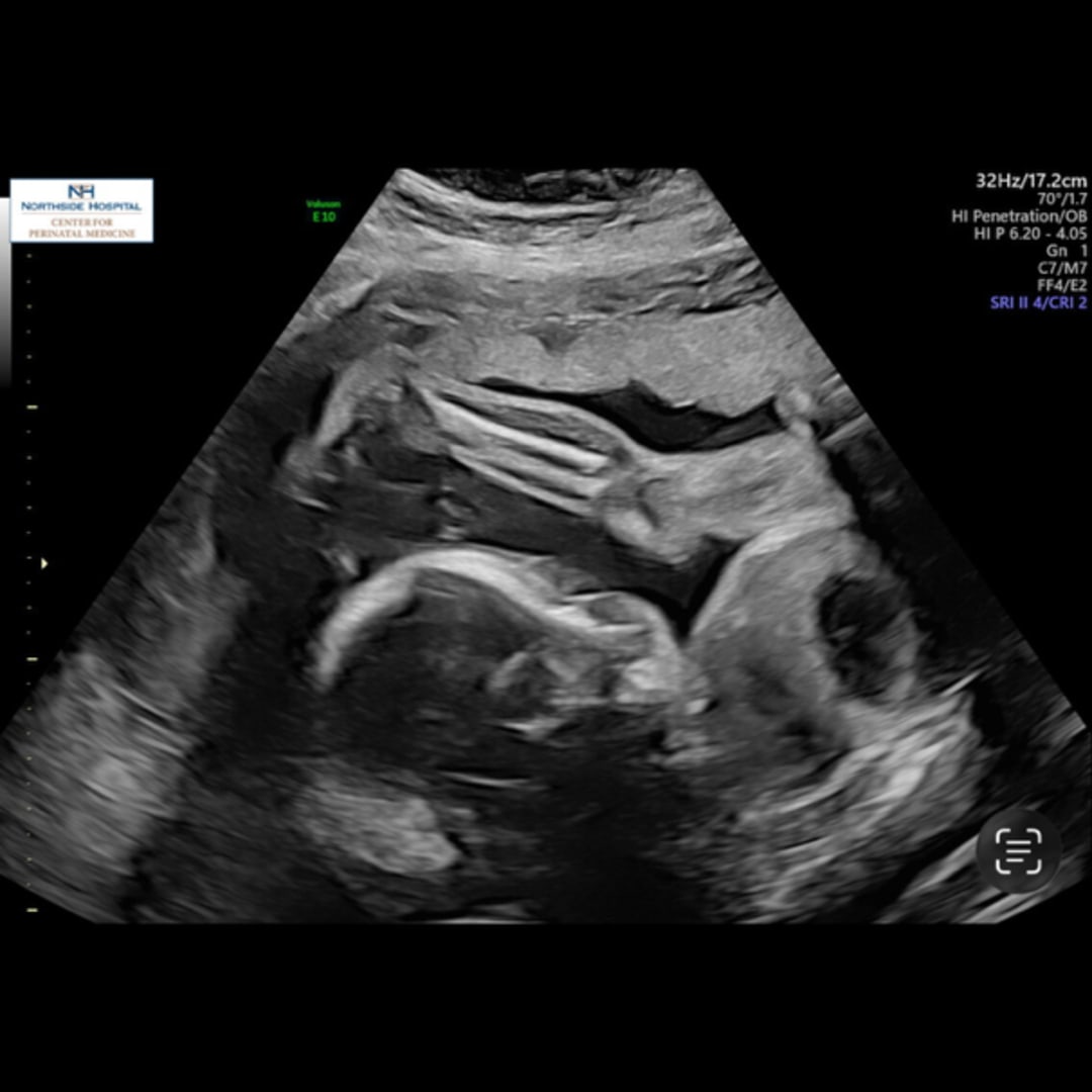 Photo shared by Kim for their Babylist baby registry.