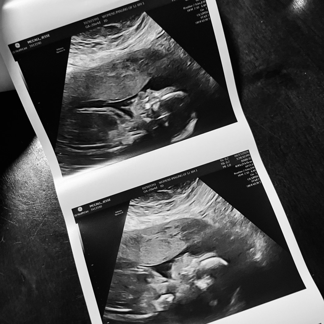 Photo shared by Jesse for their Babylist baby registry.